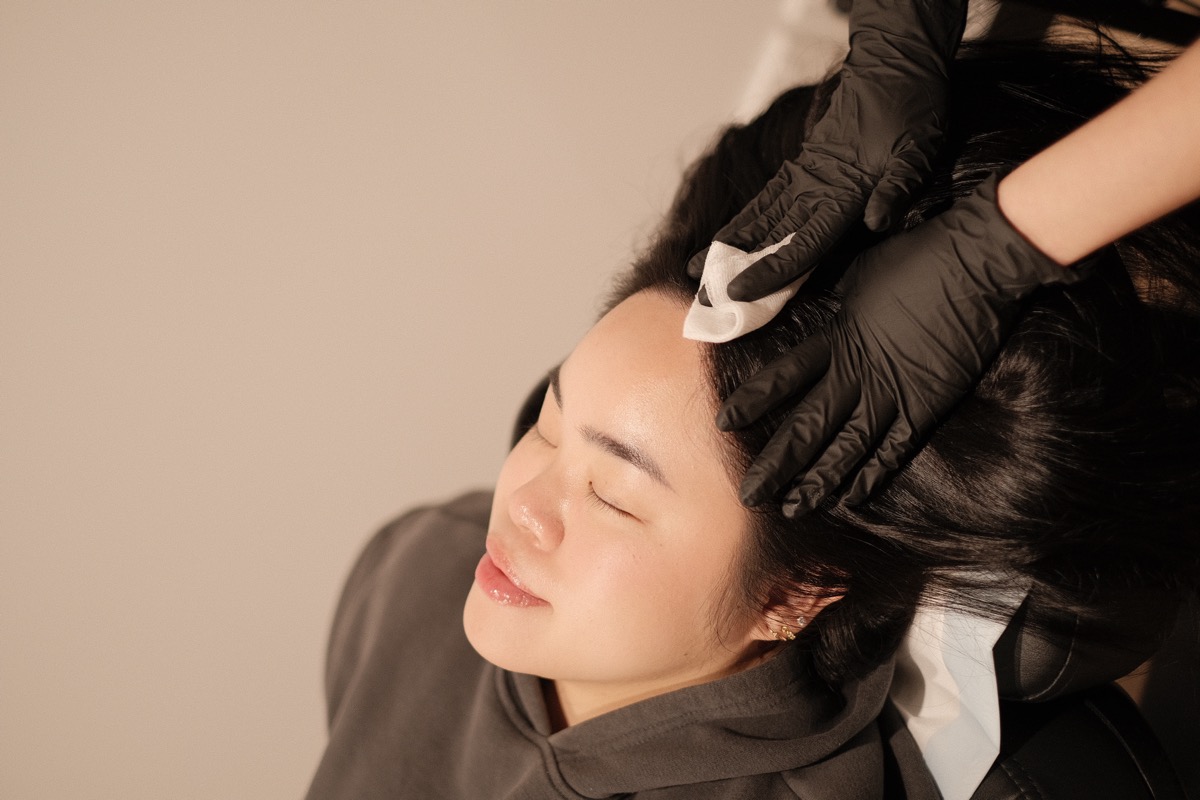 An exosome treatment session at Scalp Series