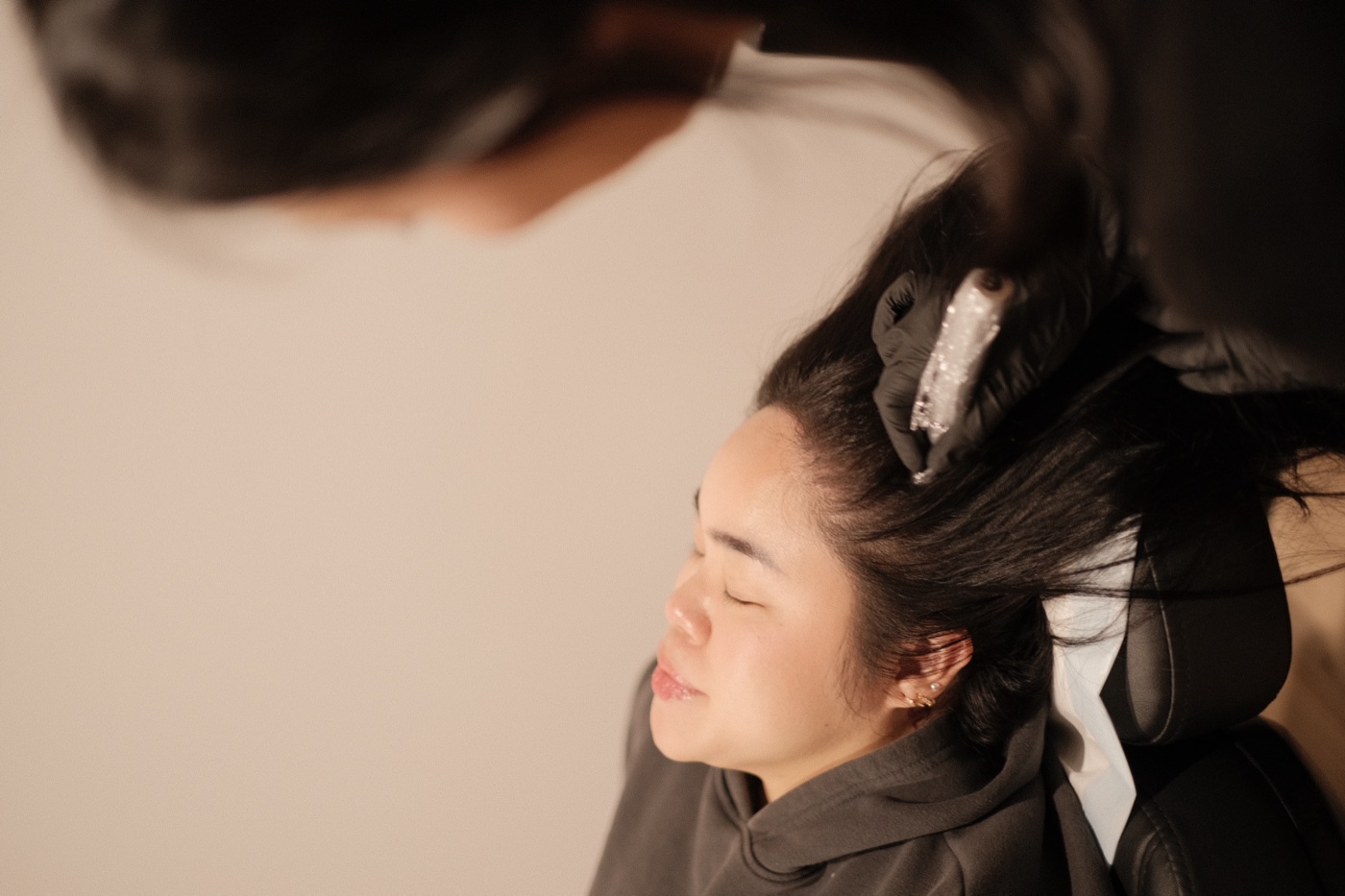 Microneedling in progress at Scalp Series