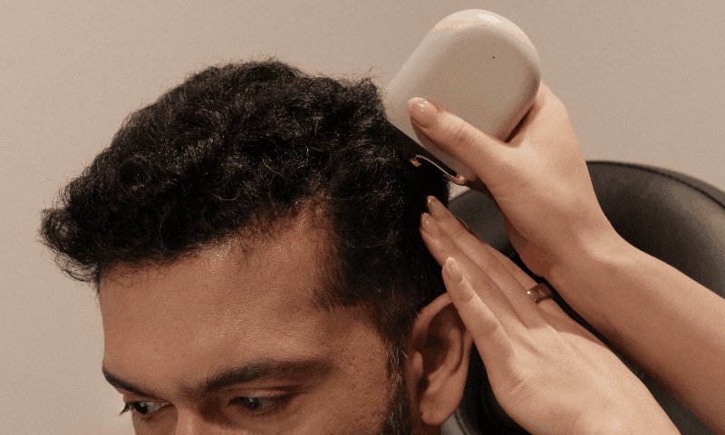 Hair loss in men