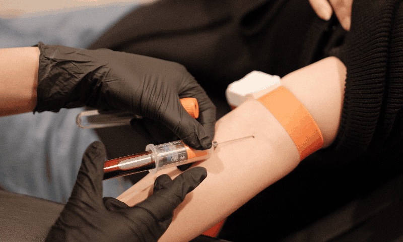 PRF therapy