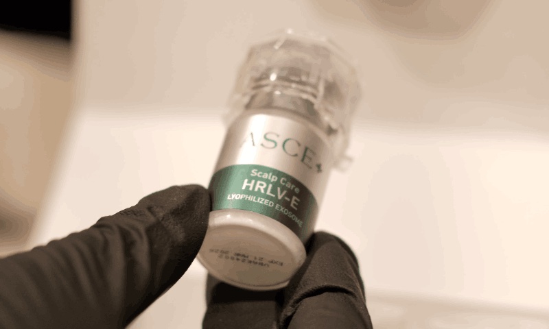 Exosomes for hair loss, explained honestly