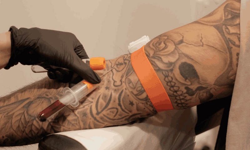 Blood tests for hair loss