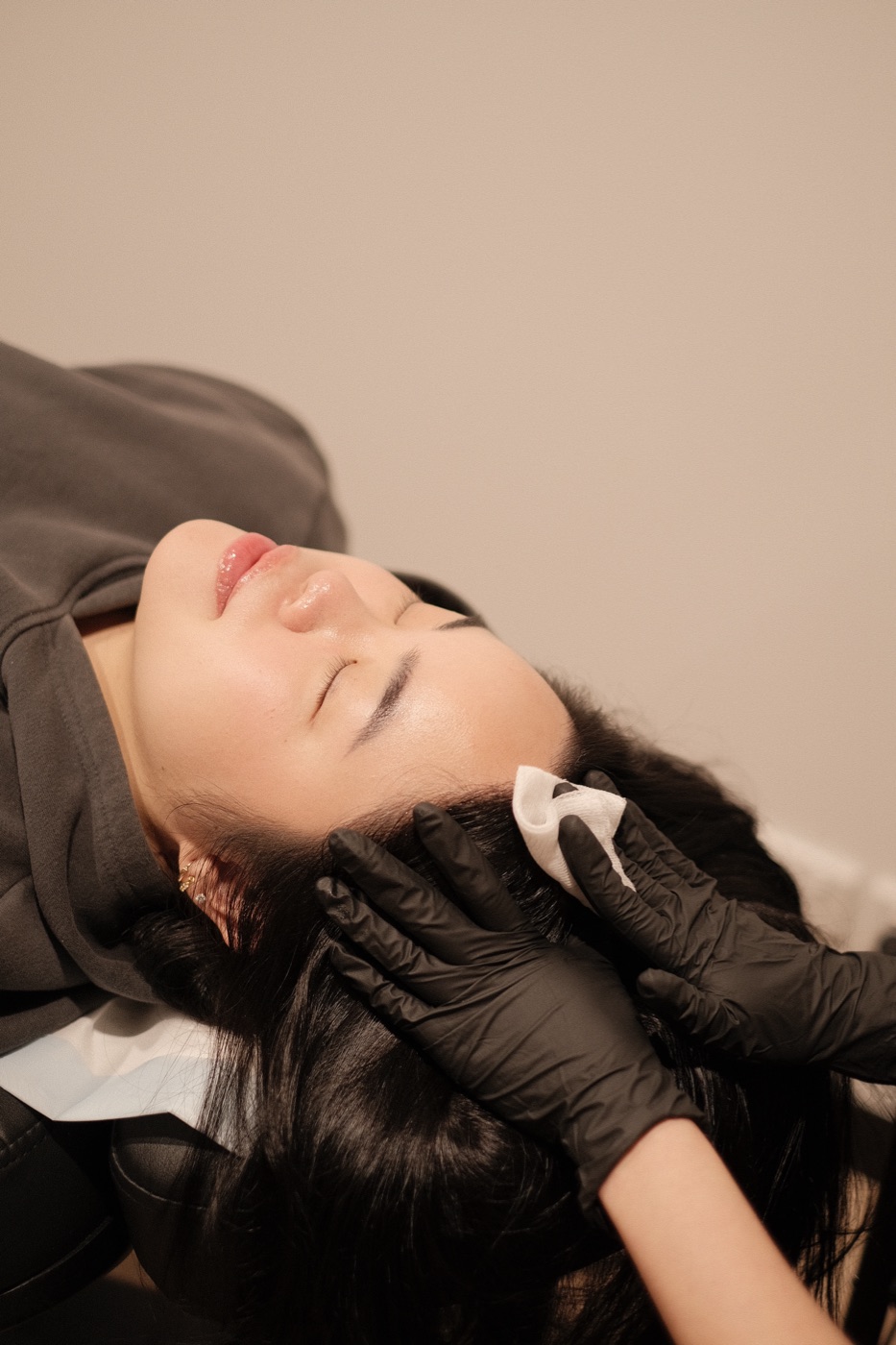 PRF and exosome combination treatment at Scalp Series