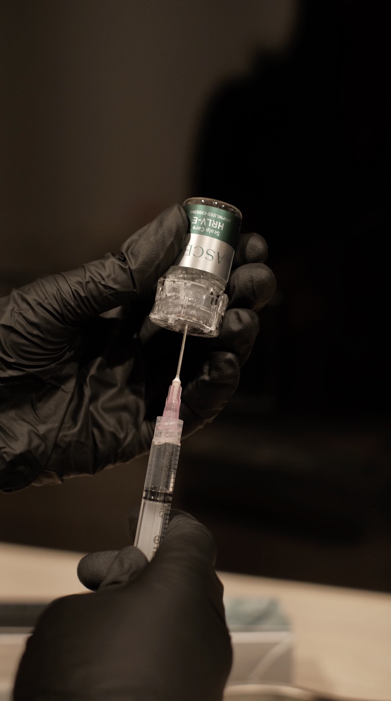 Exosome treatment vial at Scalp Series