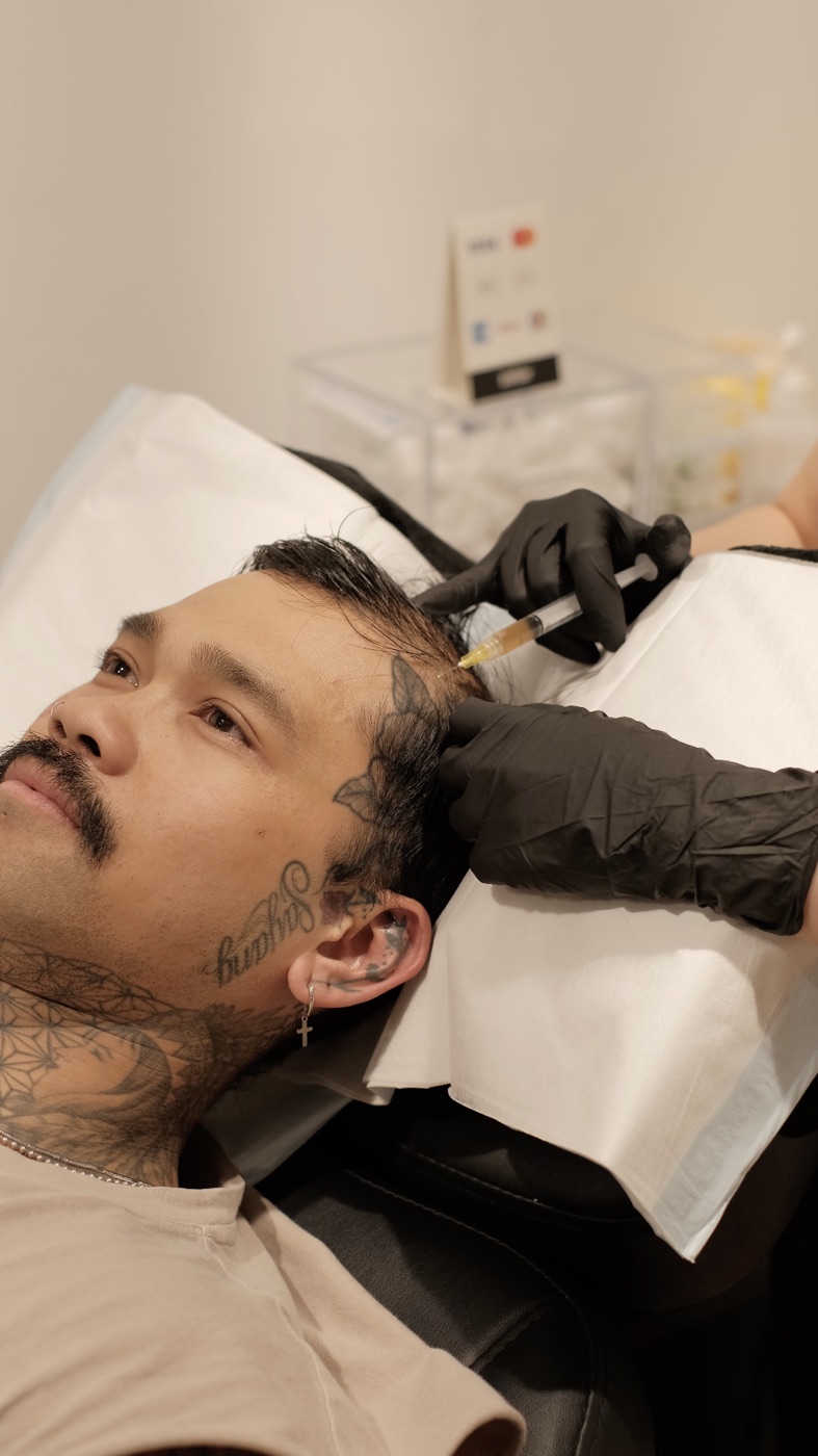 PRF preparation at Scalp Series